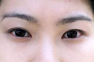 盛岡市で腰痛や肩こりを根本改善！安心して通える接骨院の施術を体験しよう
